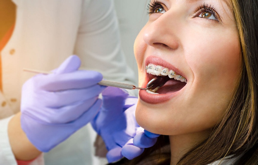 Orthodontics in adults