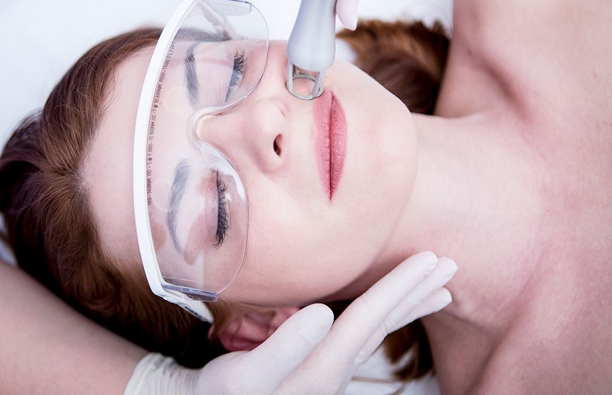 Misconceptions About Laser Skin Treatment