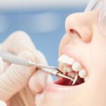 Wisdom teeth removal Sydney